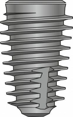 Impro Respect 6.0 x 9.5 mm RIM.- 6010