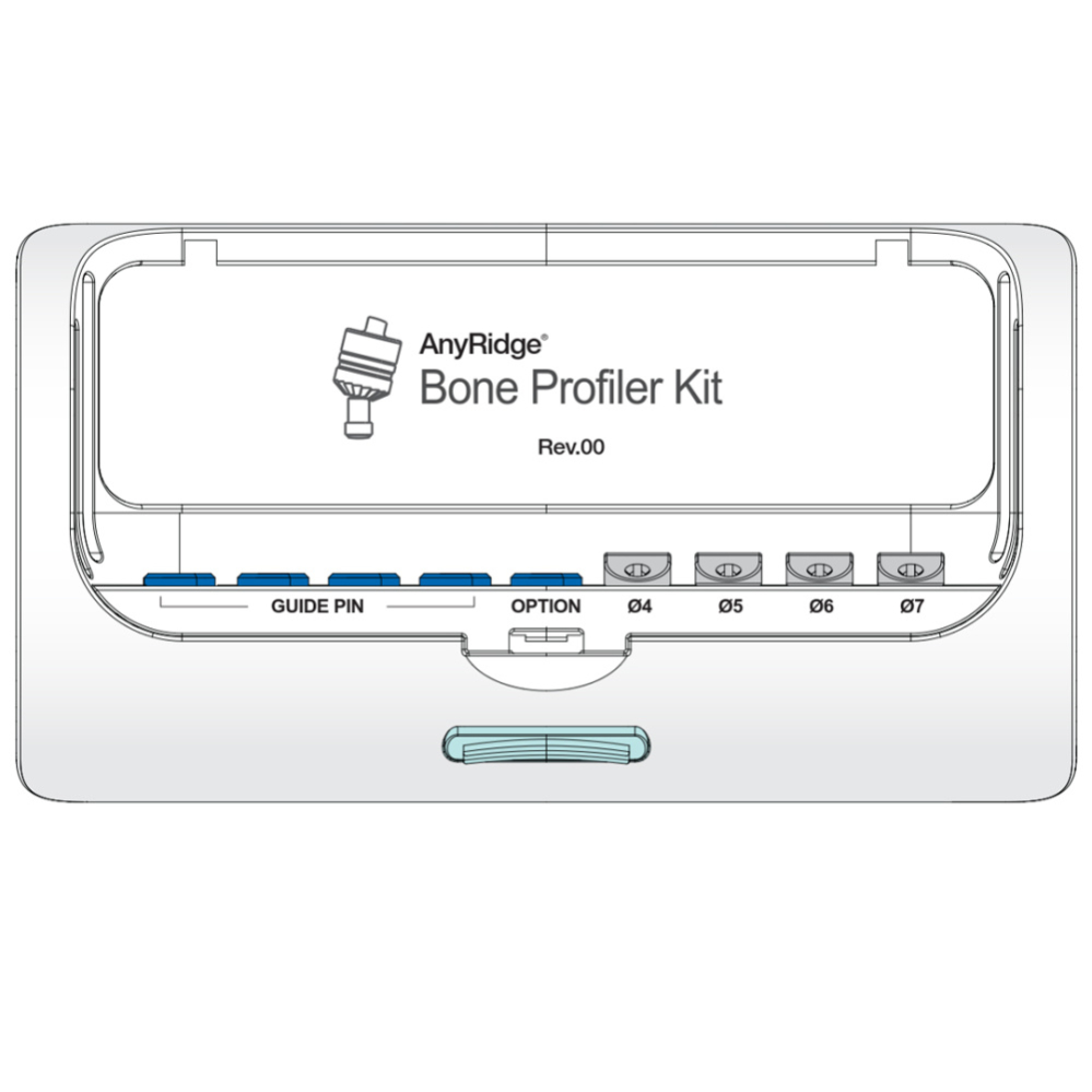 Набор для профилирования кости AnyRidge